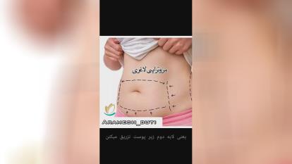 مزوتراپی لاغری در گوهردشت کرج