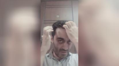 پوستر محلول گیاهی ضد ریزش مو و ضد سفیدی مو