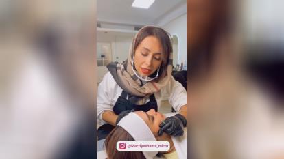 پوستر میکروبلیدینگ در هروی /مرضیه شمس/inoti