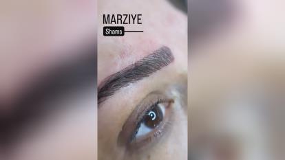 پوستر میکروبلیدینگ در پاسداران