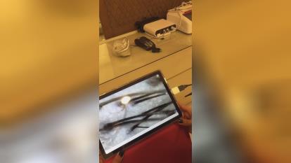 پوستر آموزش اسکراب اسکالپ تهران