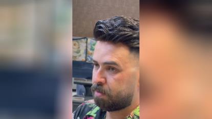 پوستر قیمت پروتز مو