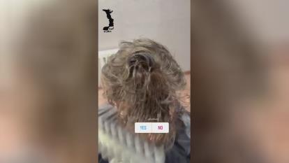 پوستر قیمت پروتز مو