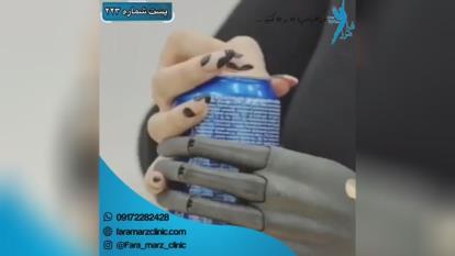 پوستر ساخت دست مصنوعی