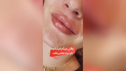 پوستر کلینیک تزریق فیلر در یزد