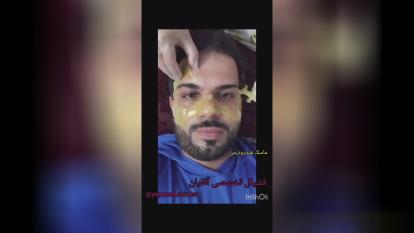پوستر بهترین مرکز خدمات فیشیال پوست در یزد