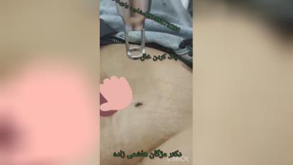 پوستر برداشتن ضایعات گوشتی در یزد