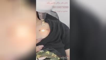 پوستر برداشتن ضایعات گوشتی در یزد