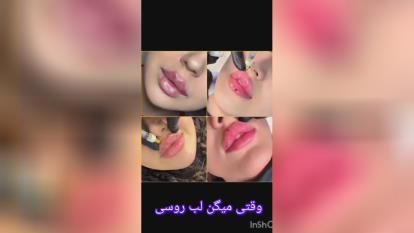 پوستر مرکز لیزر در غرب تهران مرکز لیزر و خدمات زیبایی در پونک