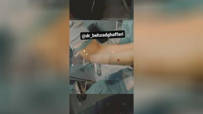 پوستر بهترین جراح پلاستیک و زیبایی در شیراز_