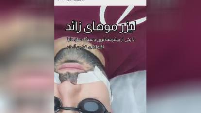 پوستر بهترین مرکز لیزر موهای زائد بانوان و آقایان در شهر ری