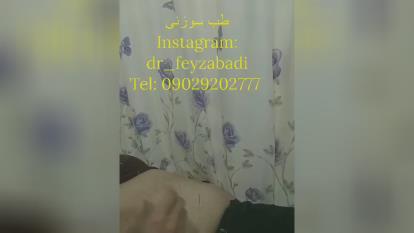 پوستر طی سنتی