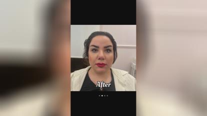پوستر بهترین کلینیک لیفت صورت در پاسداران