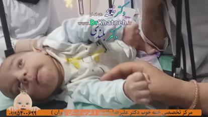 پوستر ختنه شگفت انگیز نوزاد بازیگوش بدون درد بدون خونریزی - استاد...