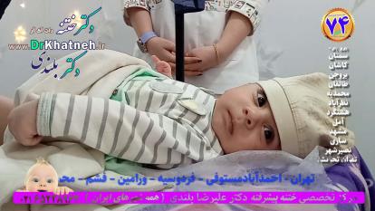 پوستر بهترین تکنیک ختنه سنتی لیزری حلقه نوزادان و کودکان 1403...