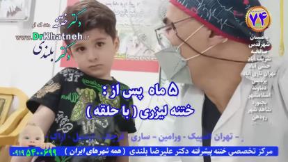 پوستر با تجربه ترین پزشک مؤفق ختنه لیزری ایران بدون بیهوشی استاد...