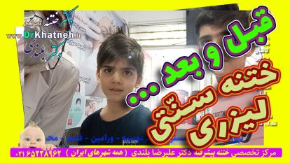 پوستر فیلم قبل و بعد ختنه سنتی لیزری استاد دکتر بلندی