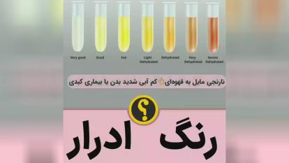 پوستر رنگ ادرار شما در مورد سلامتیتون چی میگه