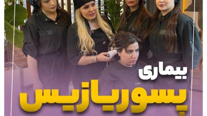 پوستر بیماری پسوریازیساسکالپ