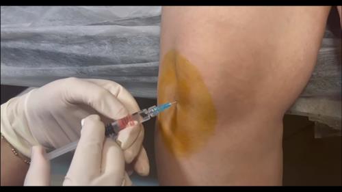 بهترین مرکز لاغری شهریار