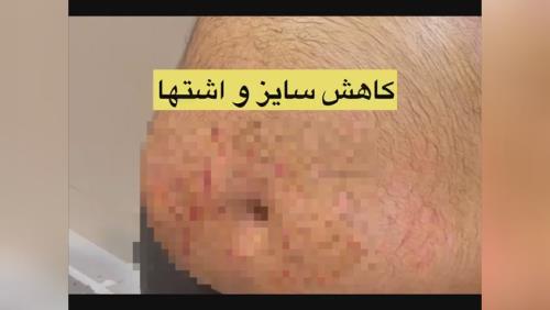 بهترین مرکز لاغری شهریار