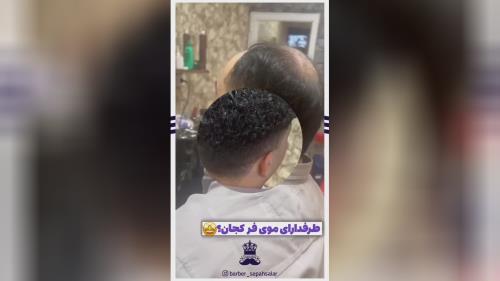 پروتز مو طبیعی بدون چسب