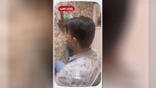 پروتز مو طبیعی بدون چسب