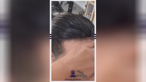 پروتز مو طبیعی بدون چسب