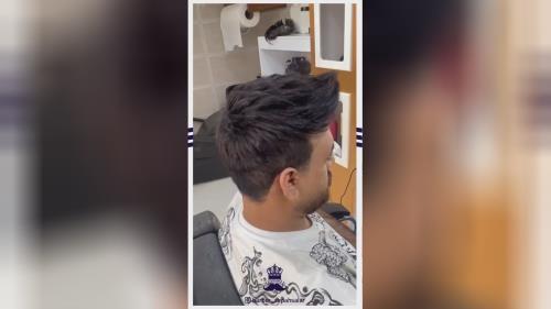 پروتز مو طبیعی بدون چسب