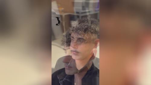 کلینیک کاشت مو در اصفهان 