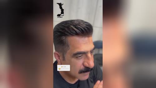 کلینیک کاشت مو در اصفهان 