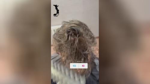 کلینیک کاشت مو در اصفهان 