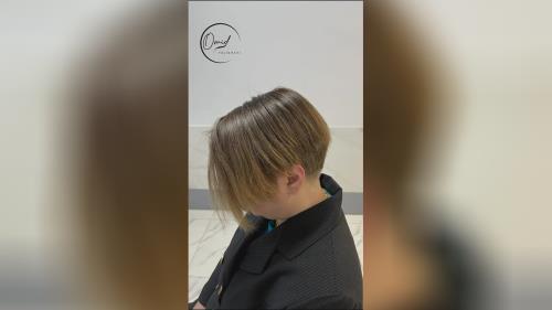 کاشت مو زنانه در اصفهان 