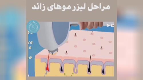 کلینیک زیبایی و لیزر مو سپاهان شهر 