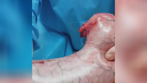 بهترین جراح اسلیو