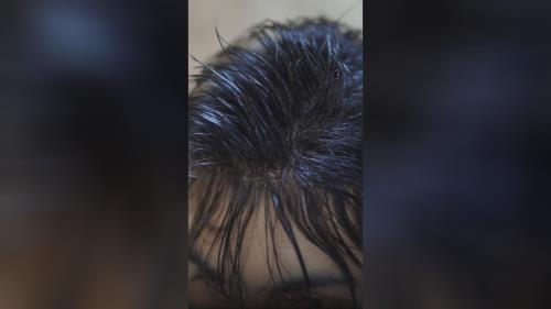 پروتز مو طبیعی بدون چسب