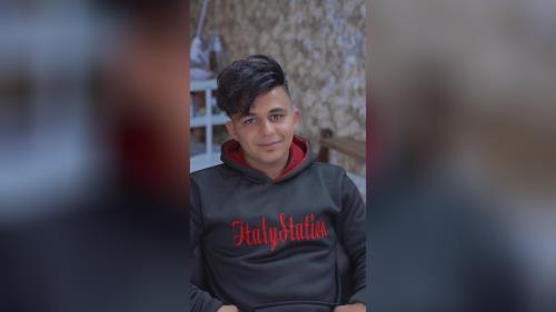 پروتز مو طبیعی بدون چسب