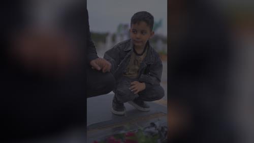 پروتز مو طبیعی بدون چسب