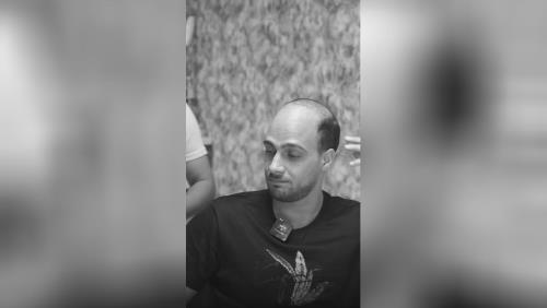 پروتز مو طبیعی بدون چسب