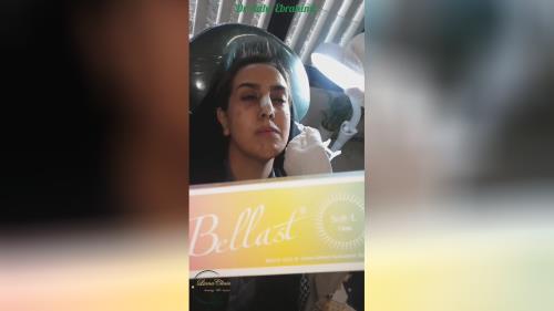 ليزر الشعر في اصفهان 