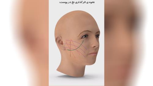 دکتر زیبایی در دزفول