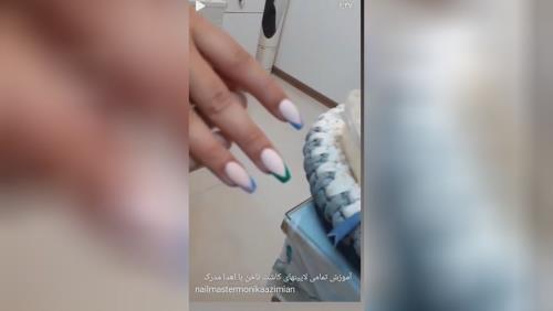 کاشت پودر و فرنچ موقت توسط هنرجو
