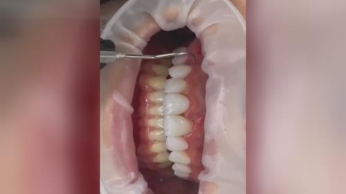 بهترین مرکز ایمپلنت تهران