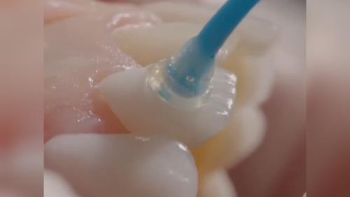 بهترین مرکز ایمپلنت تهران