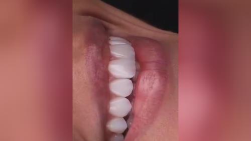 بهترین مرکز ایمپلنت تهران