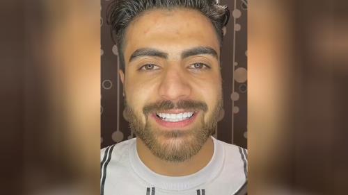 بهترین مرکز ایمپلنت تهران