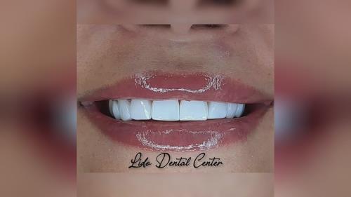 بهترین جراح دندان تهران 