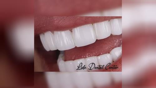 بهترین جراح دندان تهران 