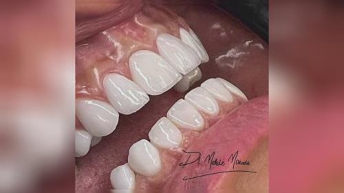 بهترین جراح دندان تهران 