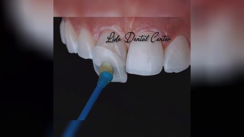 بهترین جراح دندان تهران 